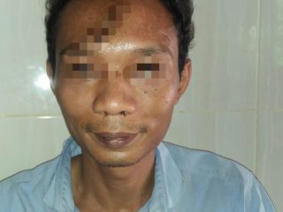 Aneh Tapi Nyata, Korban Pembacokan Membela Diri Dengan Sandal Jepit Malah Mau Dijadikan Tersangka